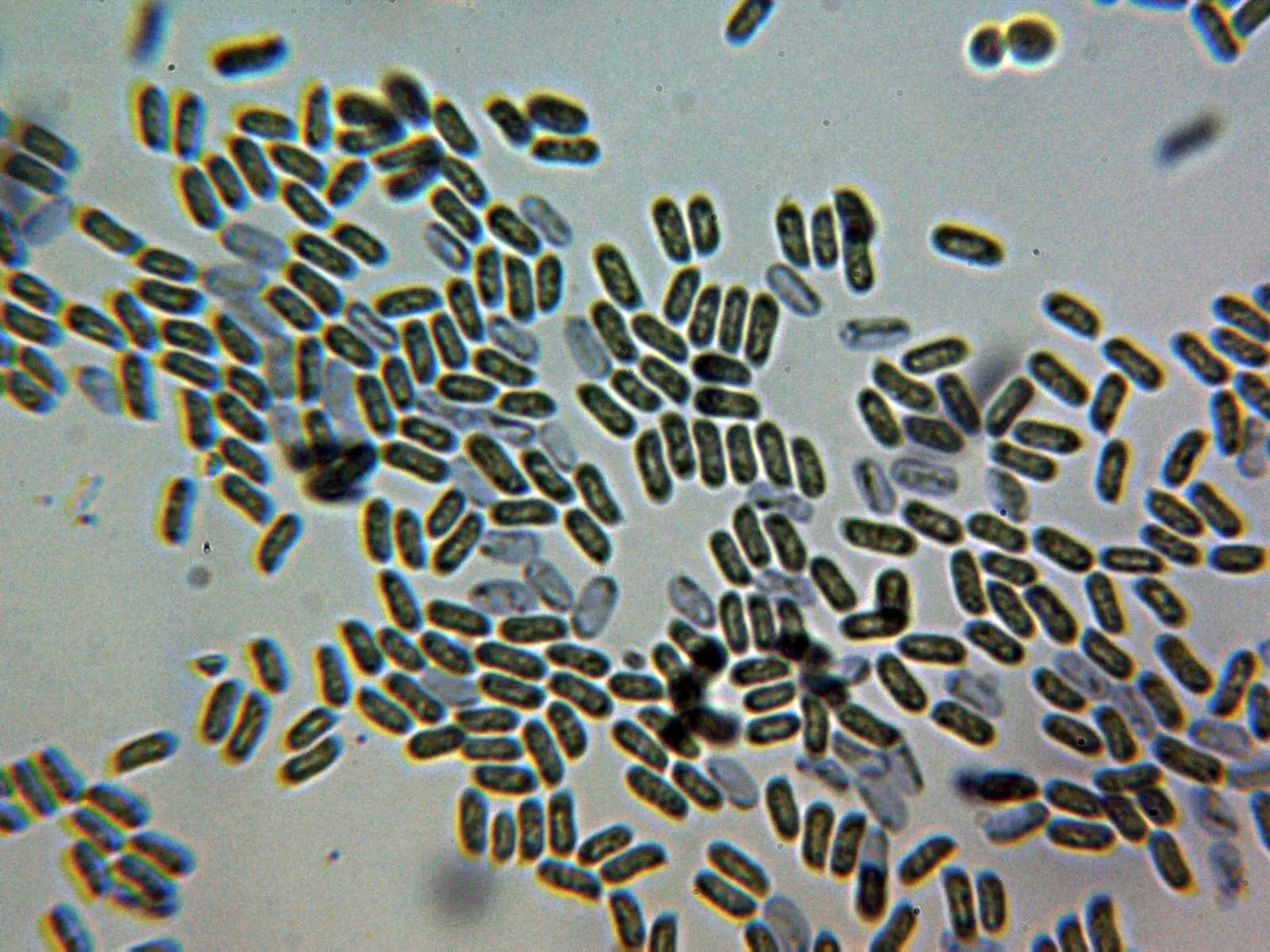 Microscopía de Stereum ochraceoflavum - 10 - Esporas Melzer amiloides